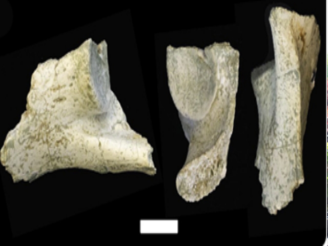 Els ossos de la pelvis del Pau