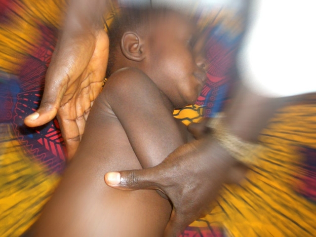 Infant de Sierra Leone tractat a través de la campanya 'Apadrina un tractament'